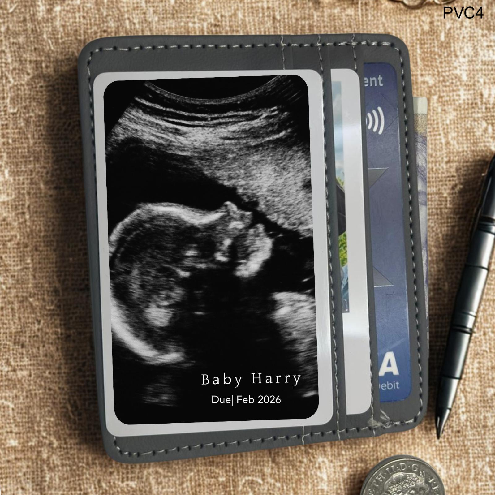 Personalized Ultrasound Photo Keepsake Card: Custom Pregnancy Announcement
